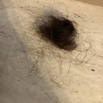 Grundig Saç Düzleştirici Saçlarımı Yaktı