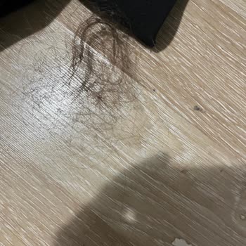 Bioblas Siyah Şampuan Saç Dökülmesine Neden Oldu