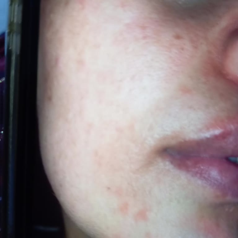 Trendyol'dan Aldığım Clasy Serumlar Cildimi Mahvetti!