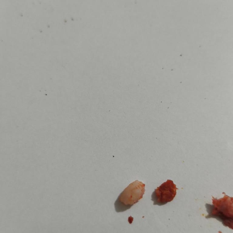 Maret Kasap Sucuk İçinde Sert Kemik Parçası Bulunması
