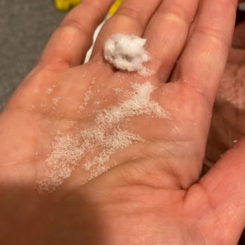 Molfix Bebek Bezinde Gizemli Kum Benzeri Maddeler