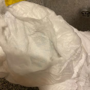 Molfix Bebek Bezinde Gizemli Kum Benzeri Maddeler