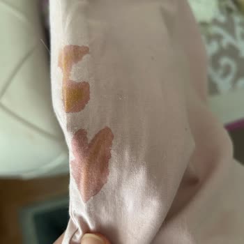 Bebek Bezlerinde Sürekli Sızdırma Sorunu