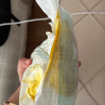 Bebek Bezlerinde Sürekli Sızdırma Sorunu