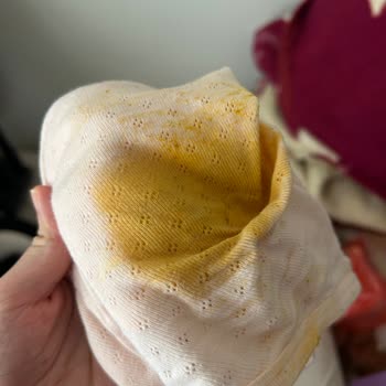 Bebek Bezlerinde Sürekli Sızdırma Sorunu