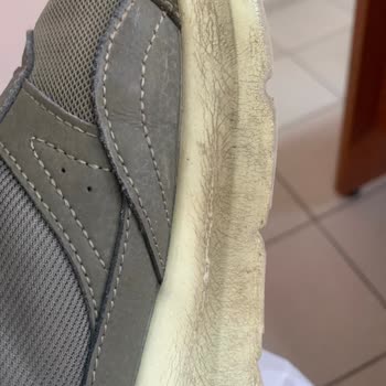 Skechers Ayakkabılarımın Tabanı Dökülüyor