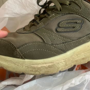 Skechers Ayakkabılarımın Tabanı Dökülüyor