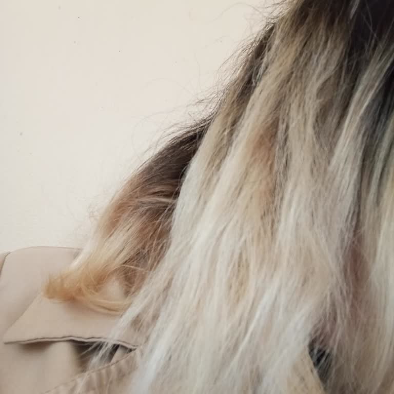 Uygun Fiyat Aldatmacasıyla Saç Yandı, Çözüm Yok