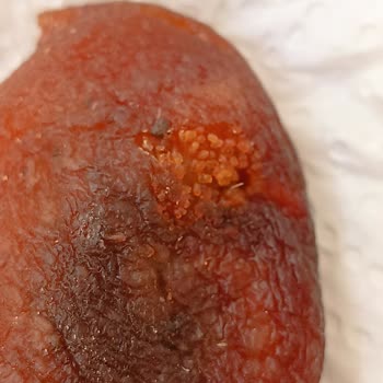 Metin Baharat | Sivas Hijyen Sorunu ve İlgisiz Personel