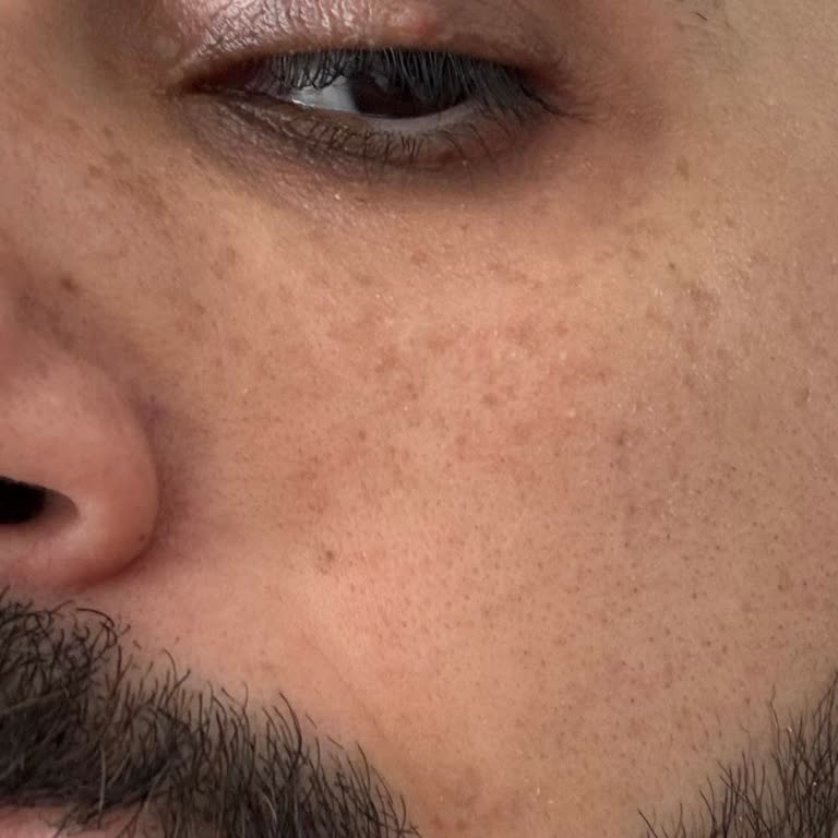 Aura Dermotoloji Kliniği'nden Şikayetçiyim