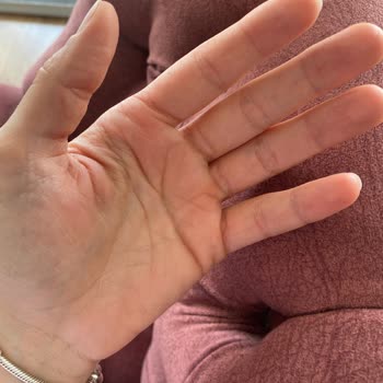 Buharlı Temizlik Makinesi Buhar Kaçırıyor Ve Yanıklara Sebep Oluyor