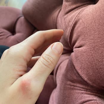 Buharlı Temizlik Makinesi Buhar Kaçırıyor Ve Yanıklara Sebep Oluyor