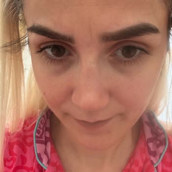 Atlas Hastanesi'nde Başarısız Burun Ameliyatı Deneyimi