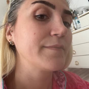 Atlas Hastanesi'nde Başarısız Burun Ameliyatı Deneyimi