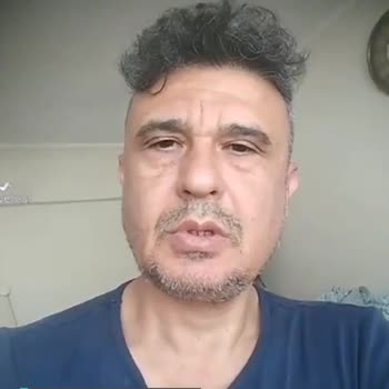 Samsung Fold 4 Katlama Yeri Çizgisi