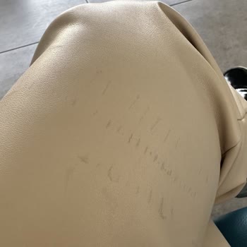 İlk Giyimde Defolu Çıkan Pantolona Müşteri Hatası Denilmesi Mağduriyet Yarattı