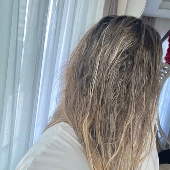 Hamilelikte Saç Boyama Sonrası Büyük Hayal Kırıklığı Ve Mağduriyet