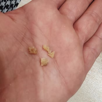 Gofretin İçinden Tırnağa Benzer Sert Cisim Çıktı, İnceleme Talep Ediyorum