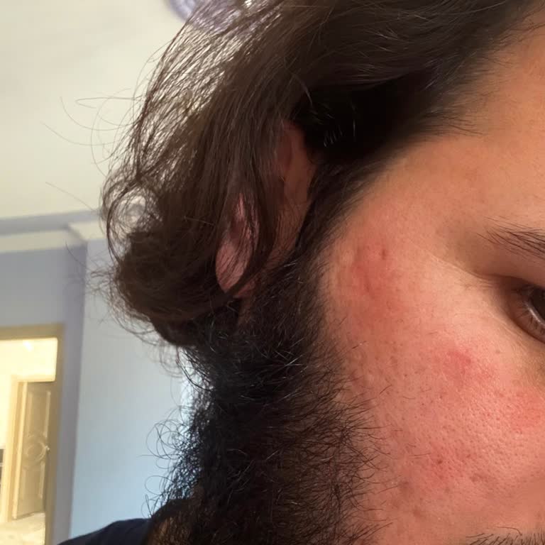 Alerjik Reaksiyon Sonrası Olumsuz Müşteri Hizmetleri Deneyimi