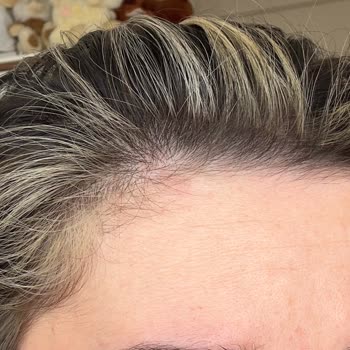 Perfect Kuaför Memnuniyetsiz Hizmet Ve Saçta İstenmeyen Sonuçlar