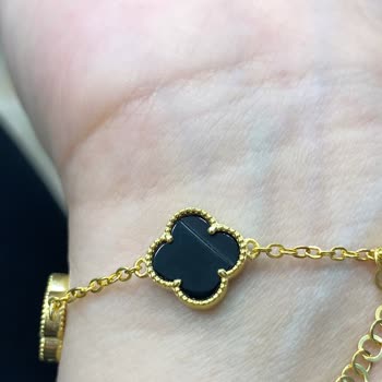 Hatalı Bileklik Gönderildi, Müşteri Hizmeti Yok