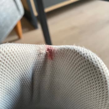 Skechers Ayakkabı Bilek Yaralanması Ve Ürün Kalitesi Sorunu