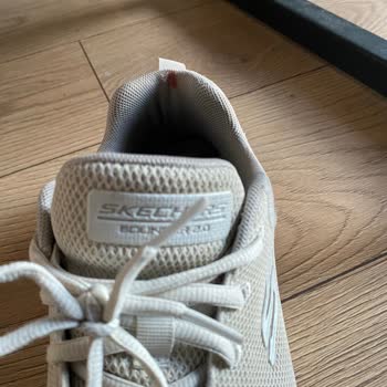Skechers Ayakkabı Bilek Yaralanması Ve Ürün Kalitesi Sorunu