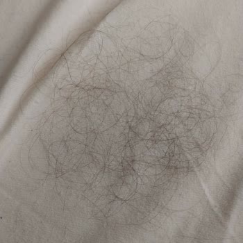 Restorex Sıvı Saç Kremi Saç Dökülmesi Ve İade Sorunu