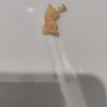 Şinitzel Ürününde Sağlık Açısından Endişe Verici Yabancı Madde