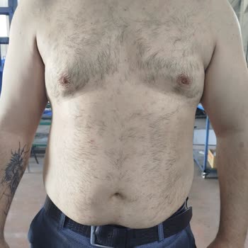 Seanslarda Dikkatsizlik Ve Ciltte Ciddi Sorunlar Yaşadım