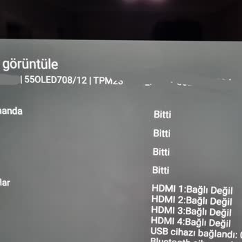 Philips Akıllı TV Kumandası Hızlı Pil Tüketimi Ve Fonksiyon Sorunları