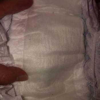 Bebek Bezi İçinde Yabancı Cisim Şoku