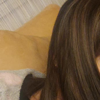 Saç Kaynak Merkezinde Memnuniyetsizlik Ve Fiyat Tutarsızlığı Deneyimi