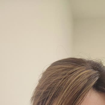 Saç Kaynak Merkezinde Memnuniyetsizlik Ve Fiyat Tutarsızlığı Deneyimi