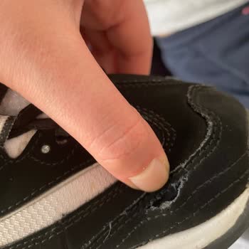 Skechers Ayakkabılarım Kısa Sürede Yırtıldı, Müşteri Hizmetleri Çözüm Sunmuyor!