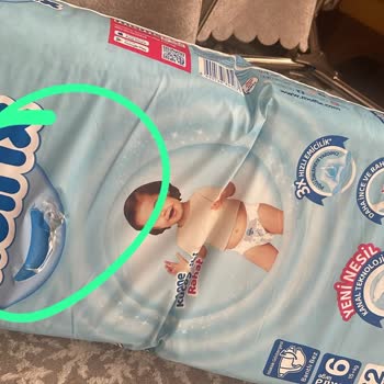 Hatalı Ve Açık Gelen Bebek Bezi İçin Müşteri Sorumluluğu Mağduriyeti