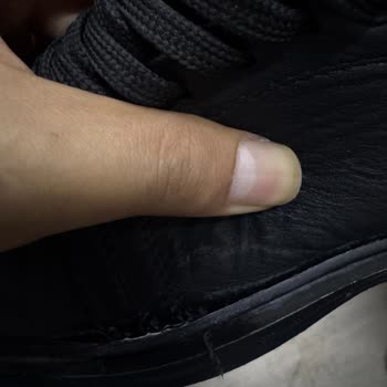 3 Haftada Tabanı Ayrılan Ayakkabı Ve Çözümde Yaşanan Zorluklar