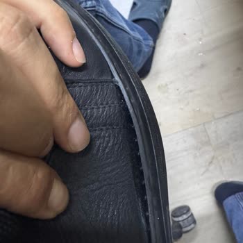 3 Haftada Tabanı Ayrılan Ayakkabı Ve Çözümde Yaşanan Zorluklar