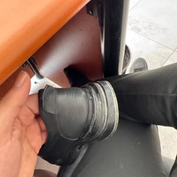 3 Haftada Tabanı Ayrılan Ayakkabı Ve Çözümde Yaşanan Zorluklar