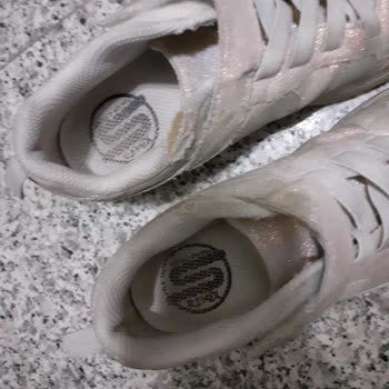 Skechers Ayakkabıda Kısa Sürede Deformasyon Ve Müşteri Hizmetleri İlgisizliği