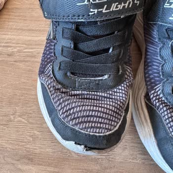 Skechers Ayakkabılarında Açılma Ve Yırtılma Sorunu, İnceleme Sonucunda Mağduriyet