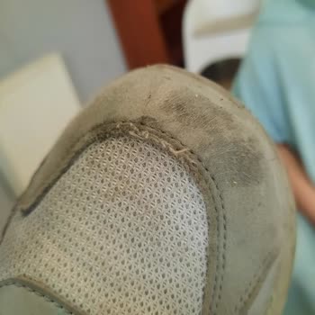 Vicco Çocuk Ayakkabısında İlk Kullanımda Deformasyon Ve Yetersiz Müşteri Hizmeti