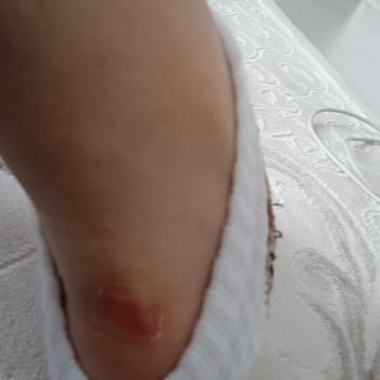 Puma Ayakkabı Ayağımı Zedeliyor, Mağduriyetim Giderilmiyor