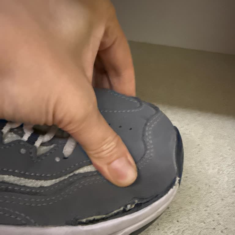 Skechers Ayakkabım Kısa Sürede Yırtıldı Kullanıcı Hatası Dediler