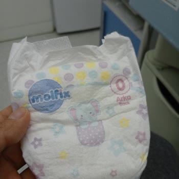 Molfix 0 Numara Bebek Bezi Prematüre Bebeklerde Sorunlu