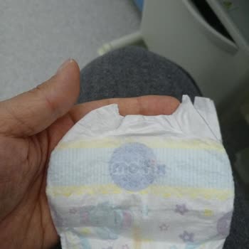 Molfix 0 Numara Bebek Bezi Prematüre Bebeklerde Sorunlu