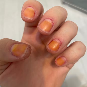 Flormar 321 Oje Tırnaklarımda Kalıcı Turuncu Leke Bıraktı