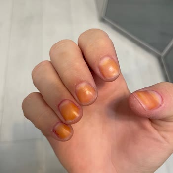 Flormar 321 Oje Tırnaklarımda Kalıcı Turuncu Leke Bıraktı