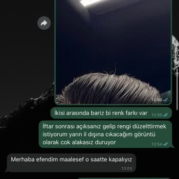 BB Saç Protez Merkezinde Hayal Kırıklığı Ve Sağlık Sorunu