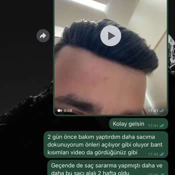 BB Saç Protez Merkezinde Hayal Kırıklığı Ve Sağlık Sorunu